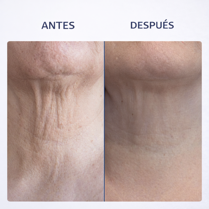 MASAJEADOR/Antiarrugas Rodillo 3D Integrado - Específico para cuello y rostro \ JAYSUING