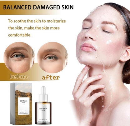 Suero Facial Calmante Centella Asiática | Reducción de Enrojecimiento, Hidratación y Mejora de Elasticidad