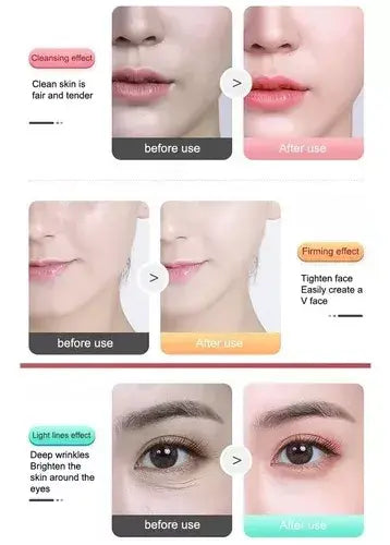 Masajeador facial  antiarrugas