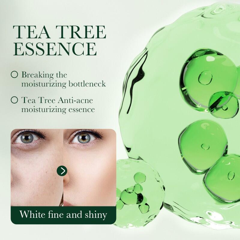 Crema Facial Control del Acné con Aceite de Árbol de Té 50ml SADOER – Purifica, Calma y Regula el Exceso de Grasa