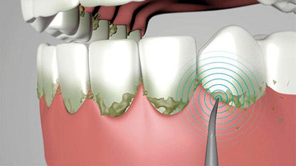 Cabezal metálico, cabezal de goma y limpiador de lengua para Starlyf Ultrasonic