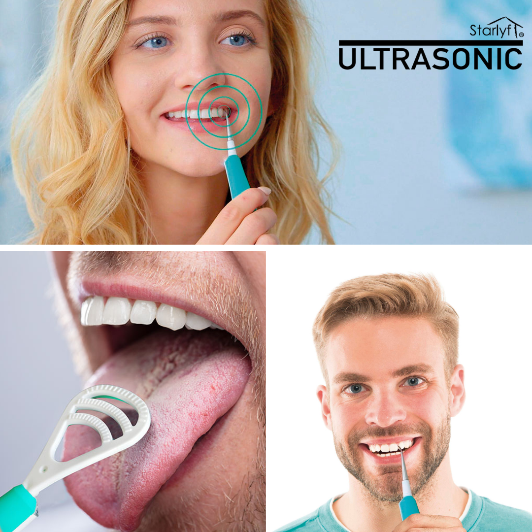 Limpiador Dental con Vibración de Alta Frecuencia - Blanqueador Dental